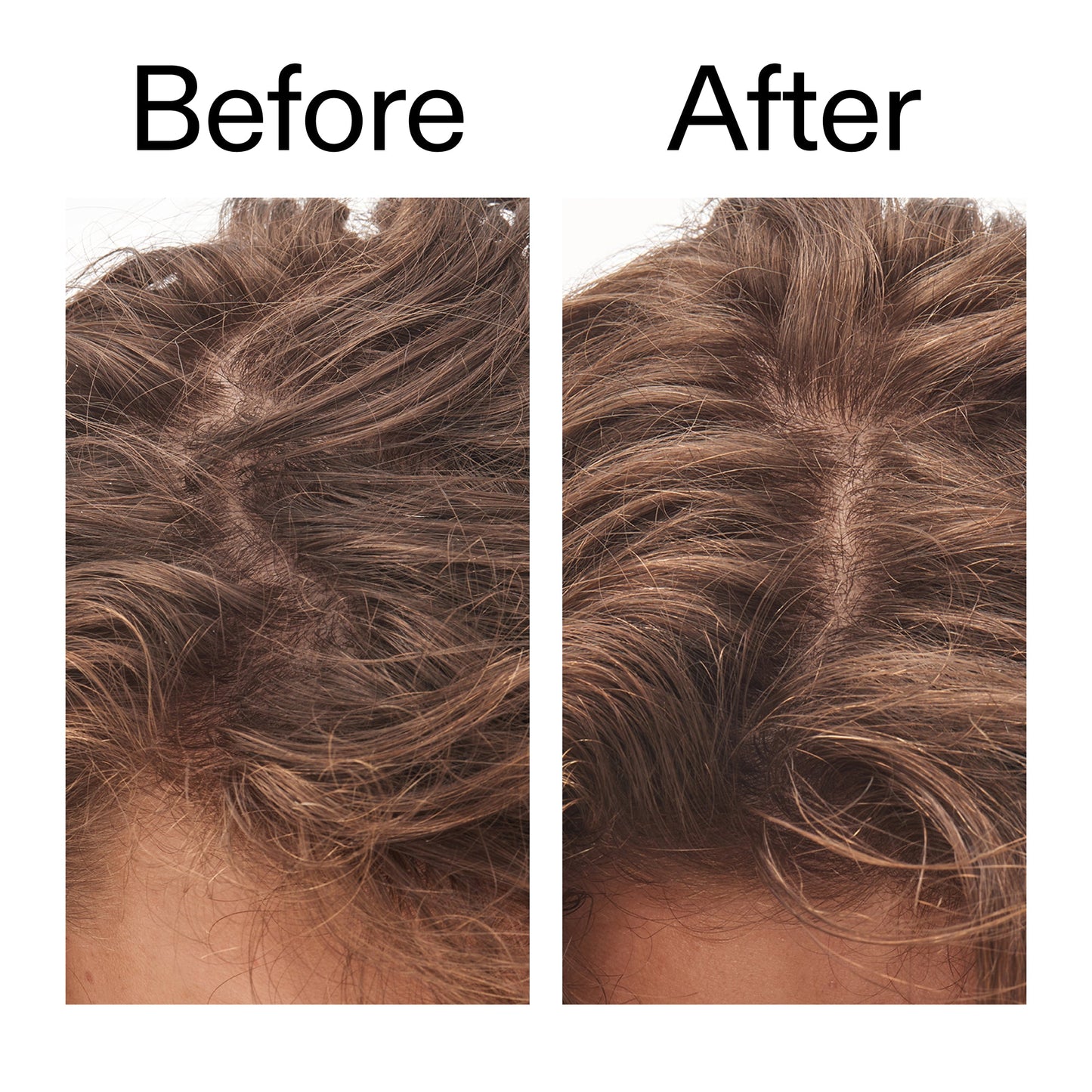 glycolic-acid-exfoliating-scalp-scrub-f3 Glycolic_Acid_Exfoliating_Scalp_Scrub_Before_After_2000x2000_b8561c87-05a1-4caa-80f7-1b6b33d750f7.jpg