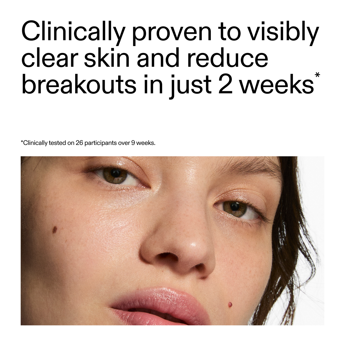 360-acne-clearing-duo-l2 360_Serum_Key_Claim.png