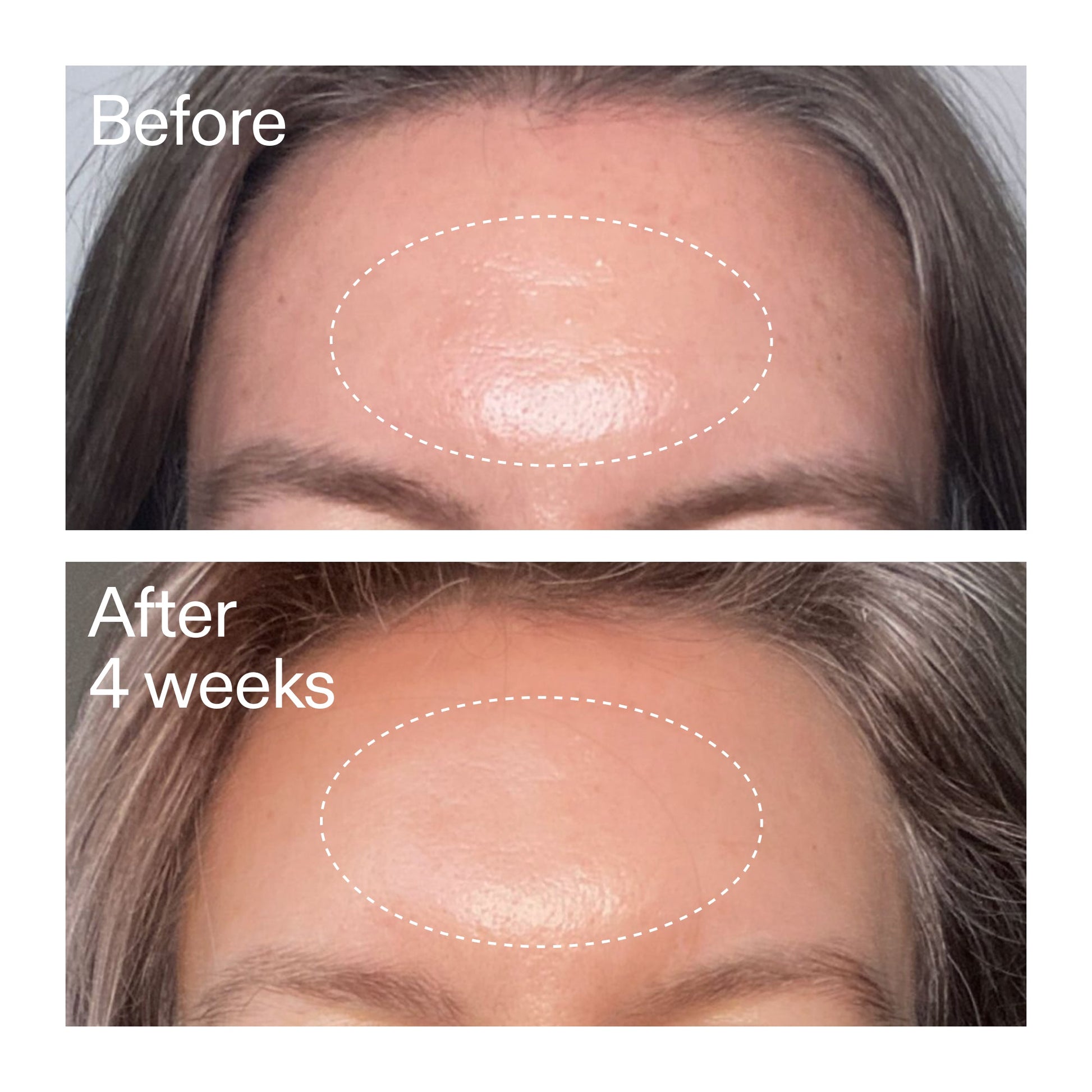advanced-0-2-retinal-serum-duo-y9 AdvancedRetinal_BeforeAfter1_2000x2000_4e9c798a-f30e-45b8-a34a-7c4740f2f2cb.jpg
