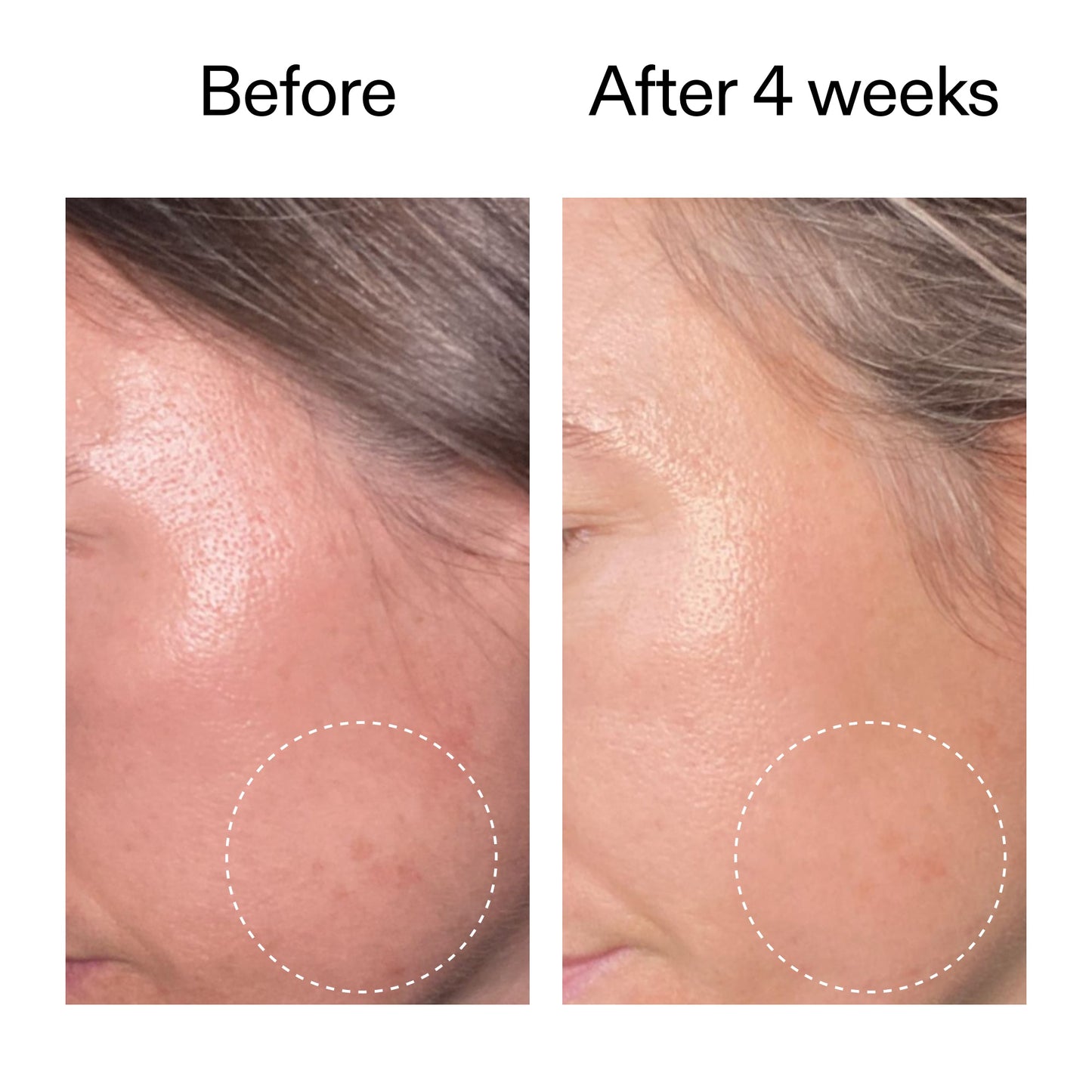 advanced-0-2-retinal-serum-e3 AdvancedRetinal_BeforeAfter2__2000x2000_62fb16bb-77ae-4d63-8500-88dbf847f4b9.jpg