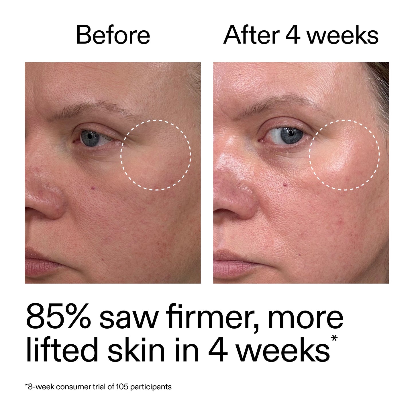 advanced-0-2-retinal-serum-e3 AdvancedRetinal_BeforeAfter_Claim1_2000x2000_bcc385c4-5e73-4f1e-aba8-64267937d0d3.jpg