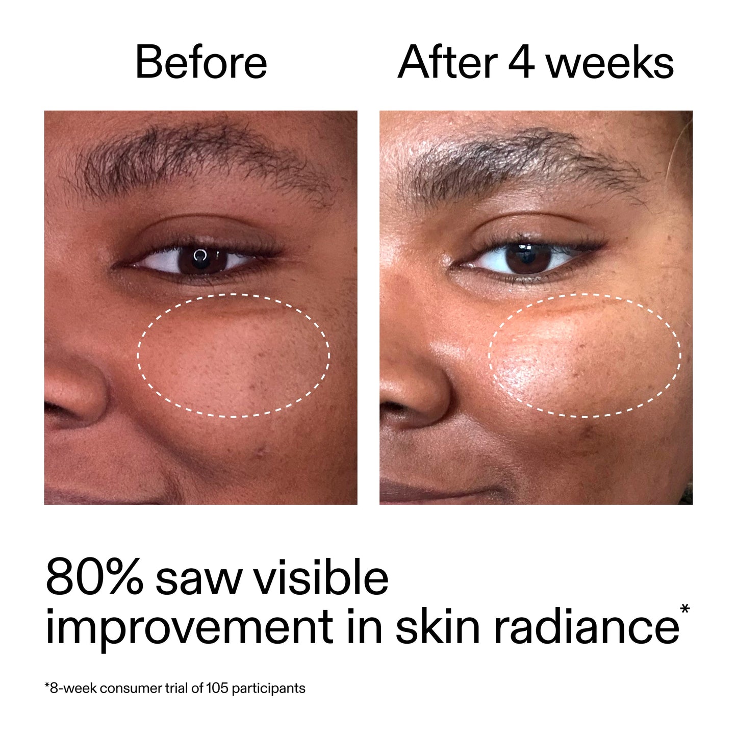 advanced-0-2-retinal-serum-e3 AdvancedRetinal_BeforeAfter_Claim2_2000x2000_39d11e3d-eda9-44ec-ab32-2903b1a368bd.jpg