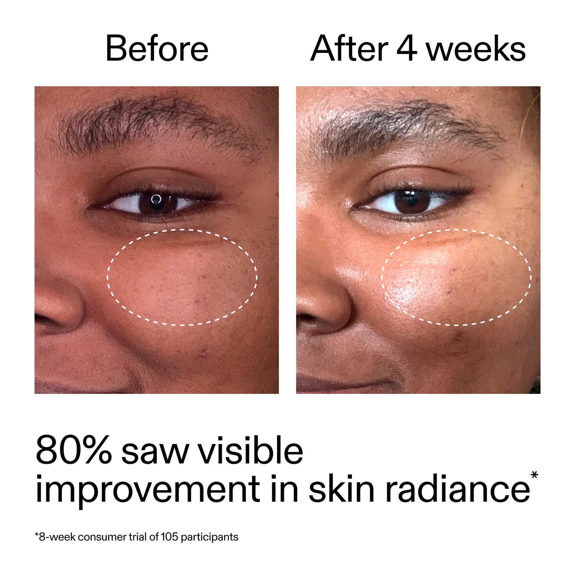 advanced-0-2-retinal-serum-e3 AdvancedRetinal_BeforeAfter_Claim2_2000x2000_39d11e3d-eda9-44ec-ab32-2903b1a368bd.jpg