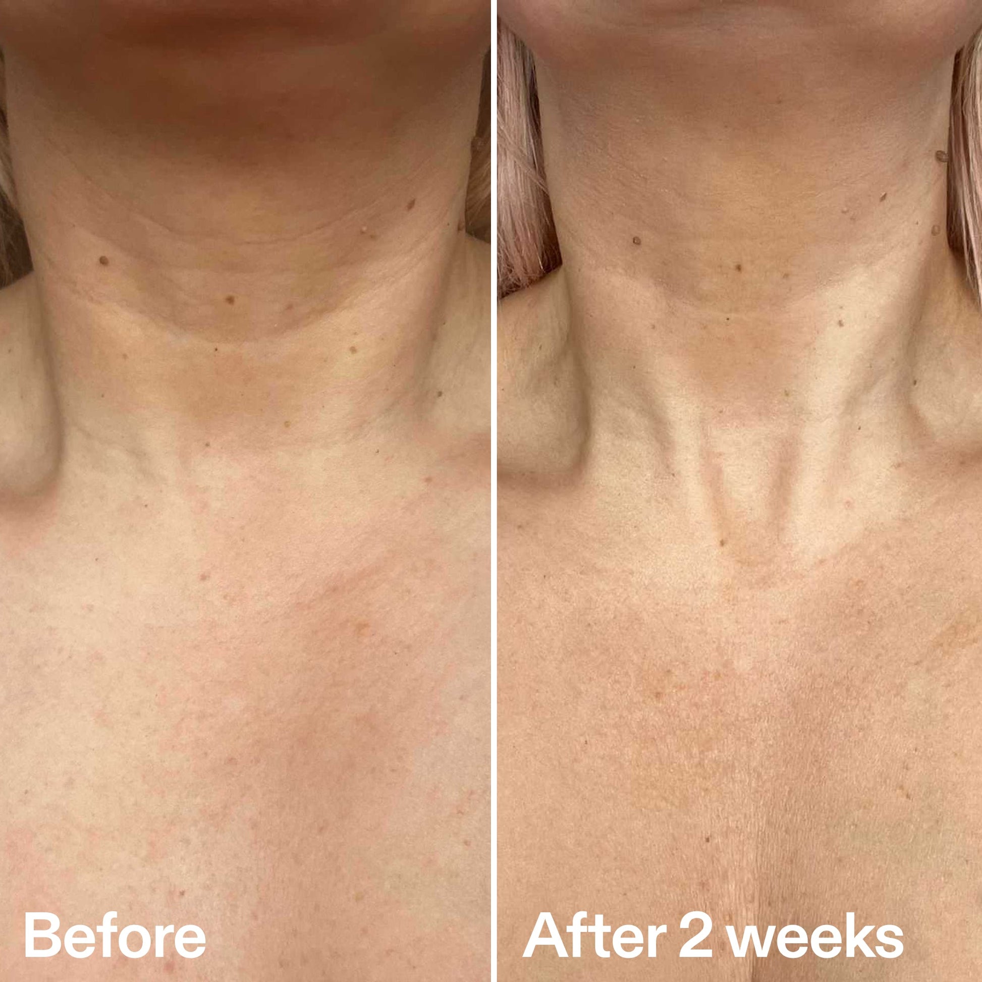 bio-active-neck-lift-stick-i4 B_A_2.jpg