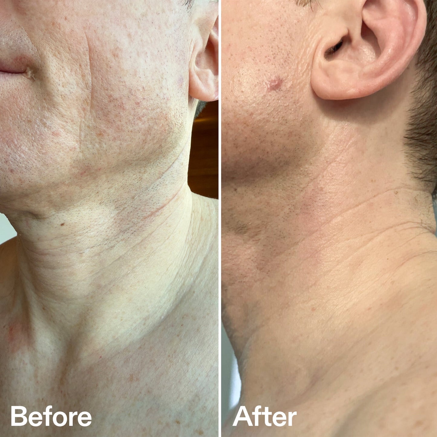 bio-active-neck-lift-stick-i4 B_A_afa2743e-b8e2-4504-92f4-e281cb6cf759.jpg
