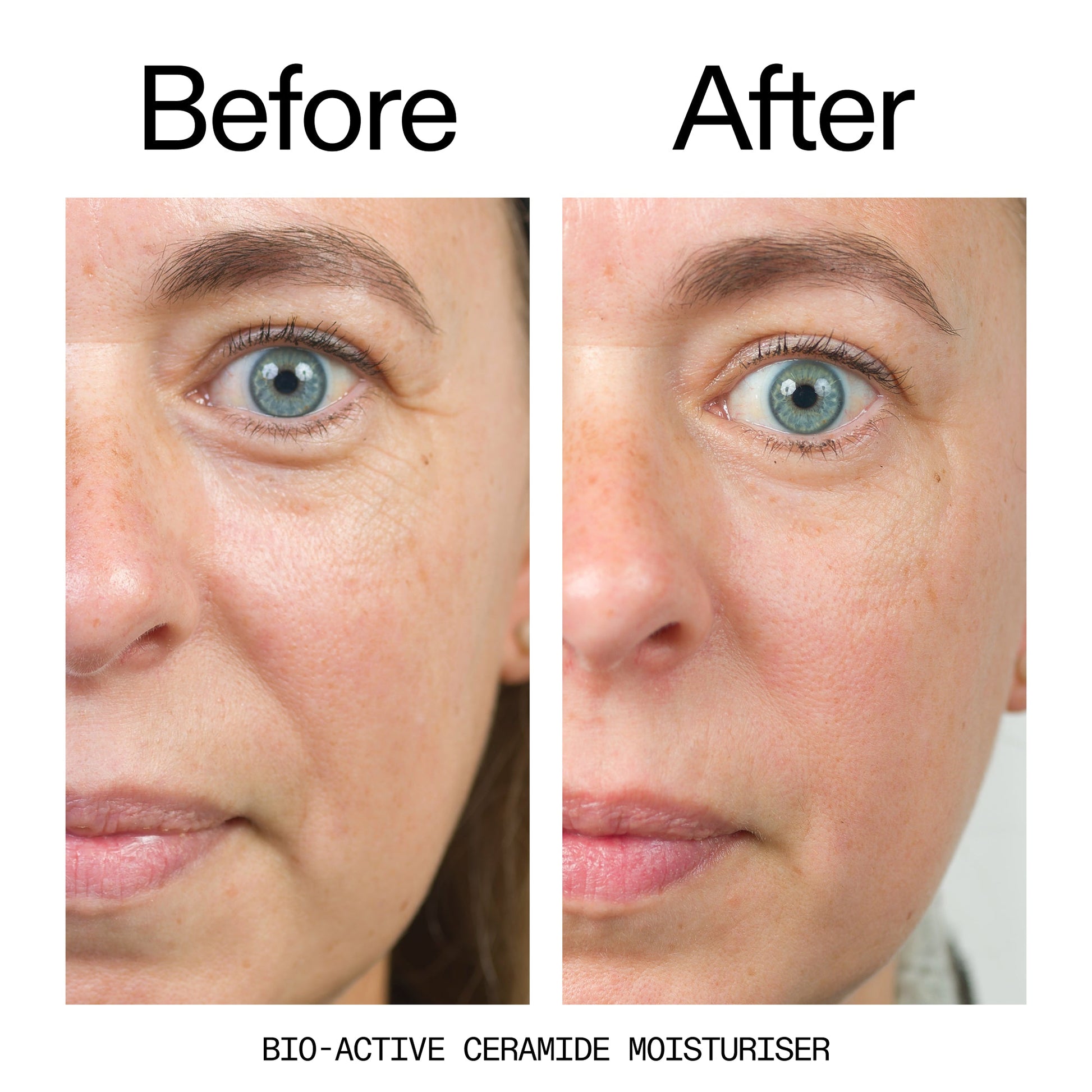 barrier-boosting-trio-z5 Bio-Active_Before_After_2000x2000_600947b4-e8c5-425a-9155-fc15bc83aa12.jpg