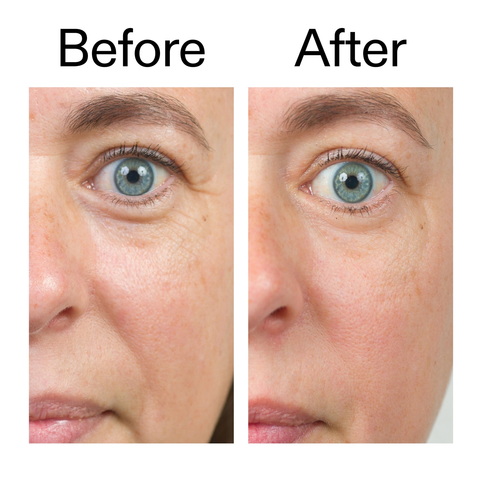 bio-active-ceramide-moisturizer-h9 Bio-Active_Before_After_2000x2000_566e5a9e-135e-417a-8242-b44e5fa35463.jpg