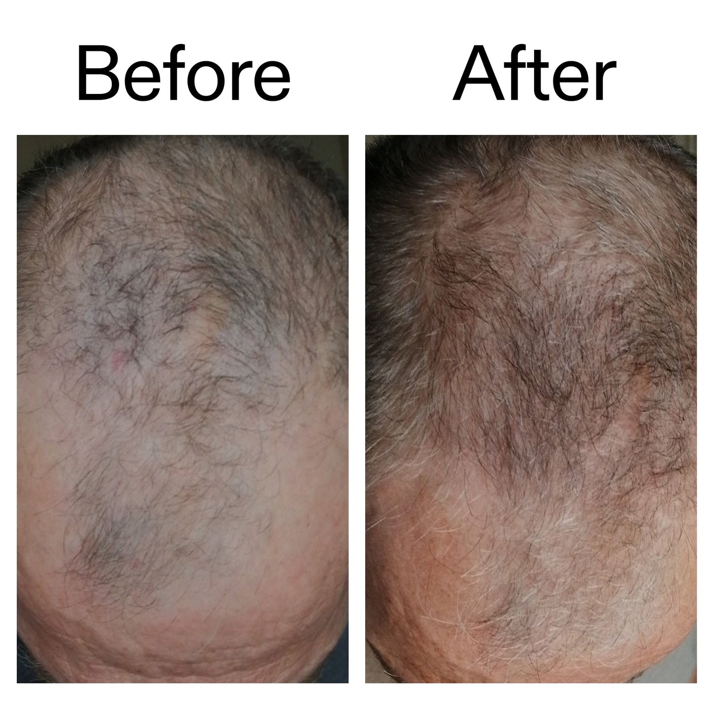 3-month-hair-growth-trio-y4 Caffeine_Scalp_Treatment_B_A_Ppage_2000_x_2000.jpg