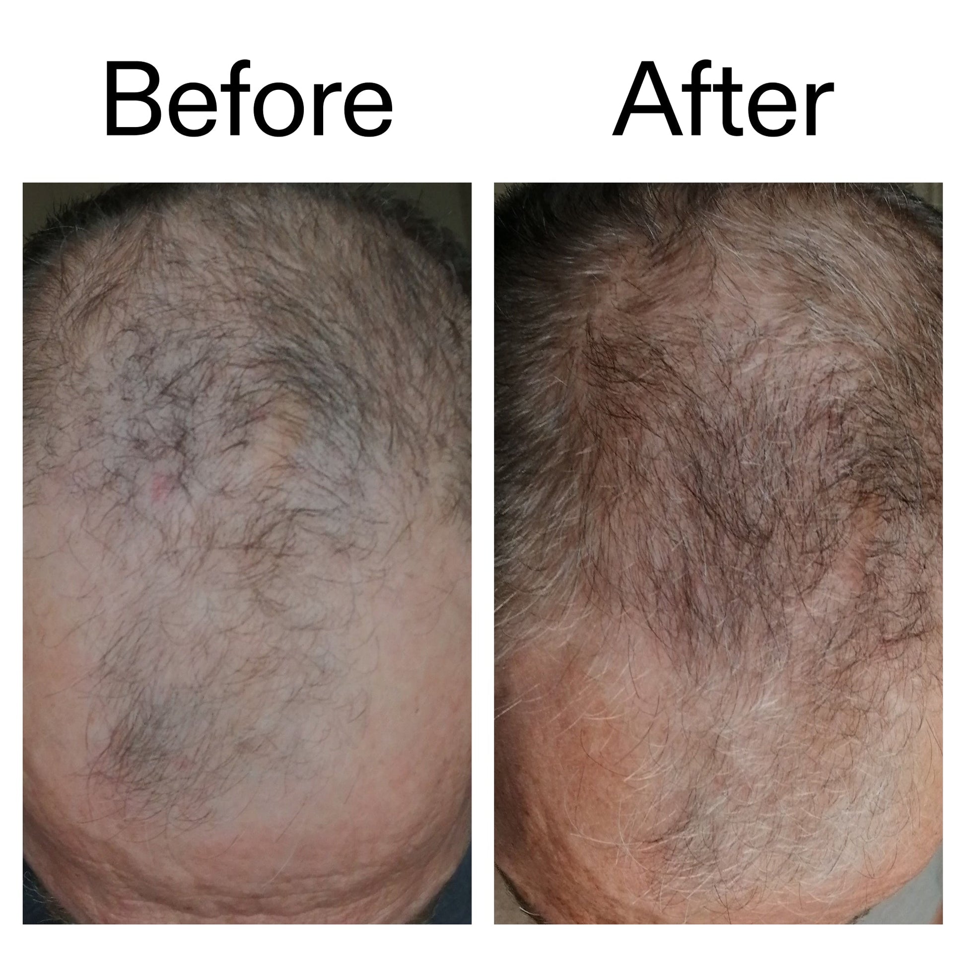 caffeine-stimulating-scalp-treatment-u8 Caffeine_Scalp_Treatment_B_A_Ppage_2000_x_2000.jpg