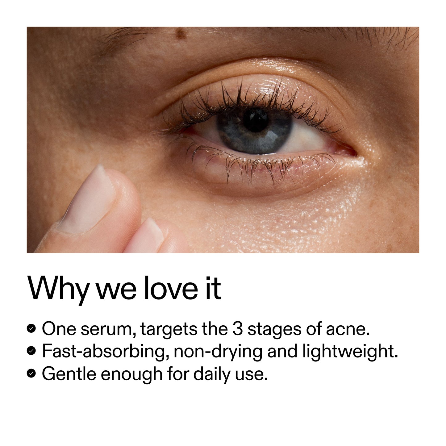 360-acne-clearing-duo-l2 Dioic_Whyweloveit_2000x2000_175aafd3-0cbe-403a-b317-a8362881bfe2.jpg