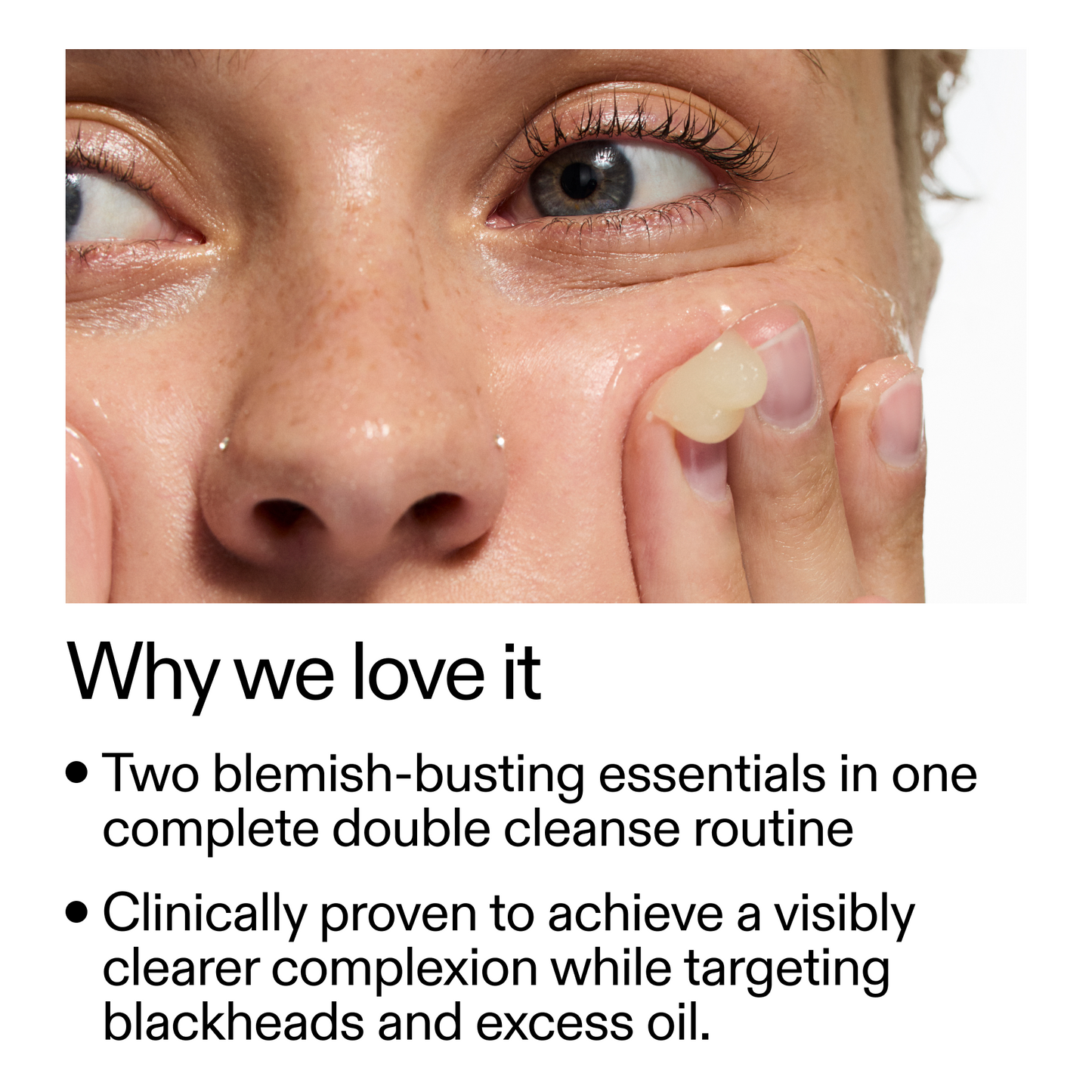 acne-double-cleanse-duo-m9 Double_Cleanse_Duo_for_Breakouts_Why_We_2000x2000_f242cb12-bb5c-487c-b203-071ccb406ec5.png