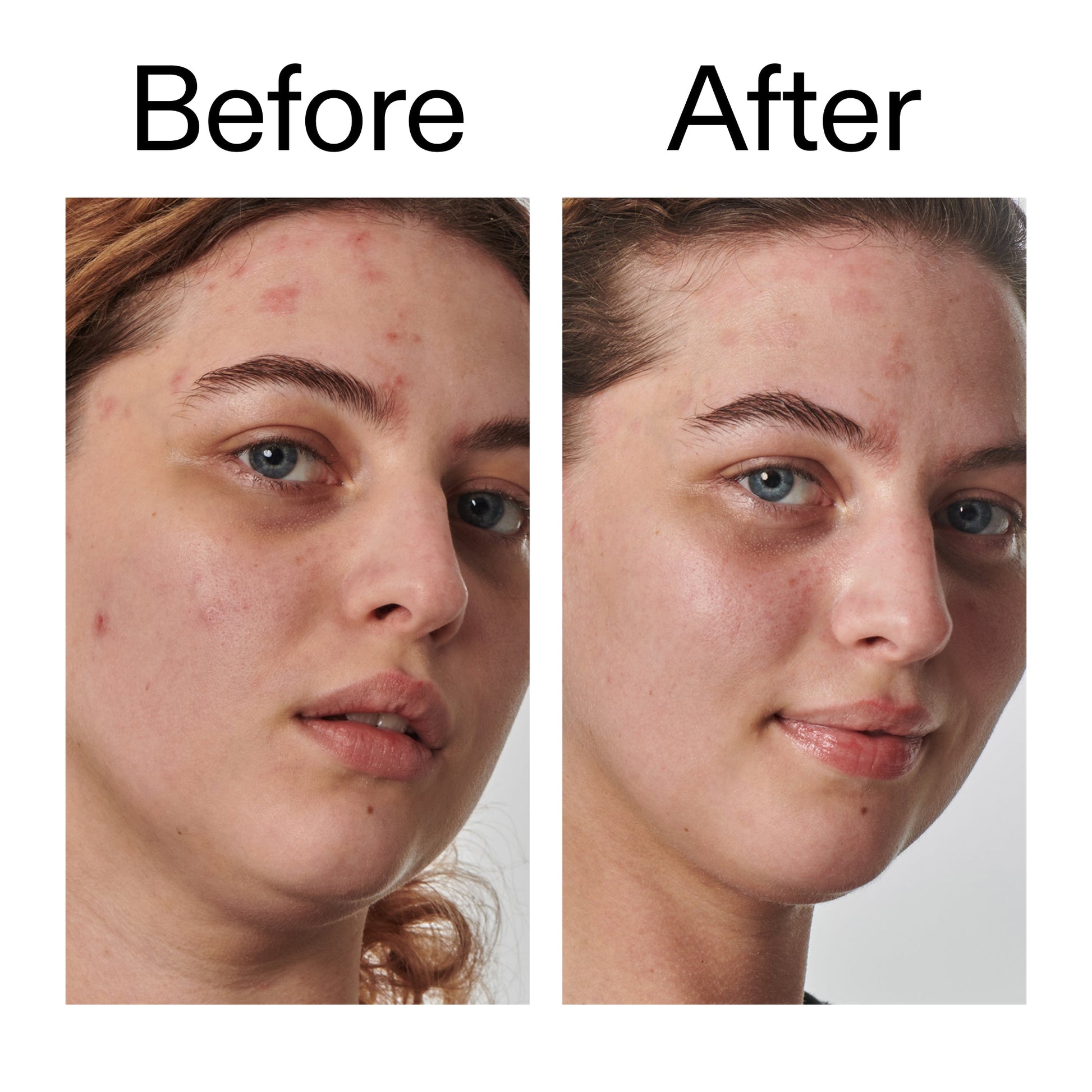 10-urea-moisturizer-o5 Dry_and_Rough_Skin_Solution_Before_After_2000x2000_efa6e639-5c39-49bd-a5dd-f0220293120a.jpg
