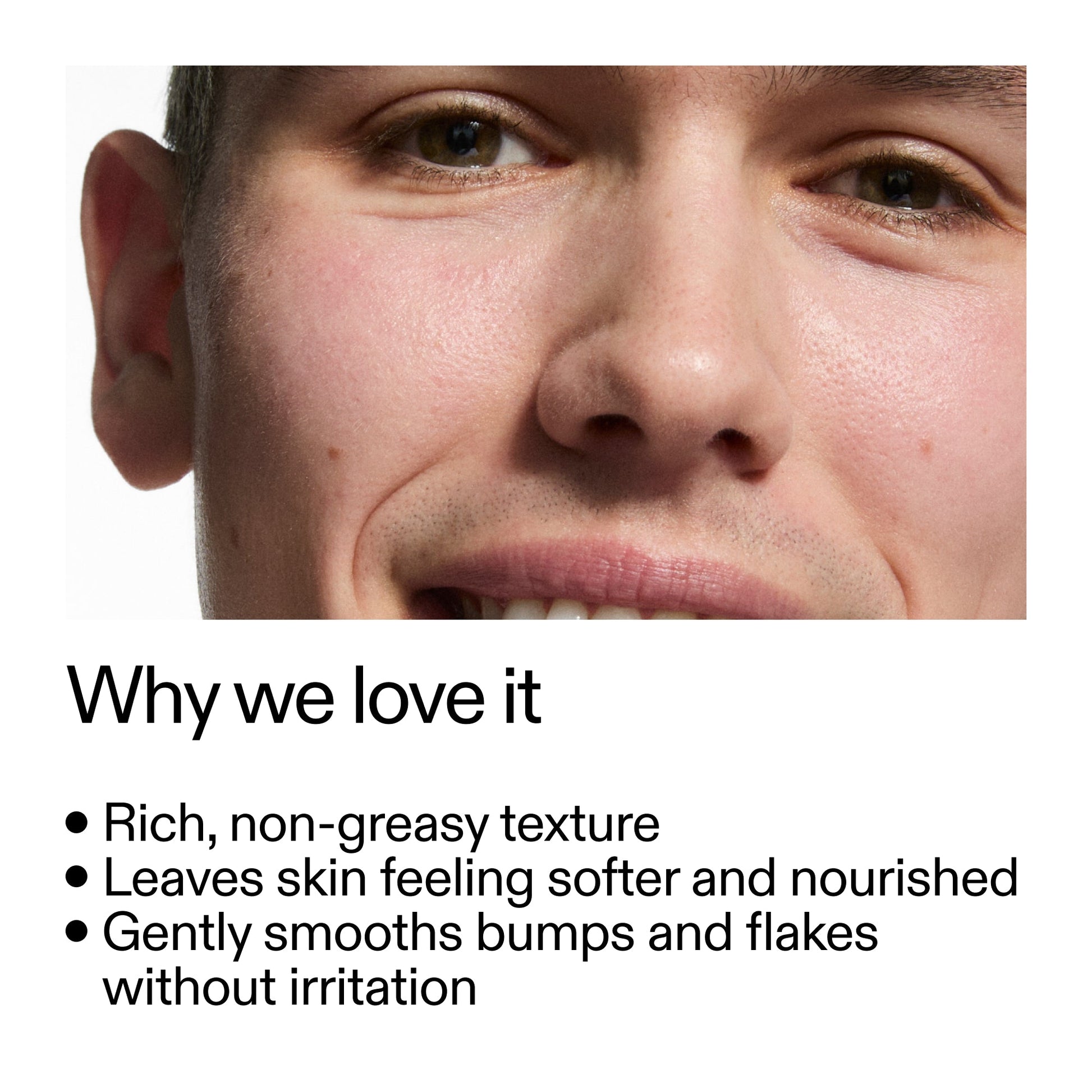 10-urea-moisturizer-o5 Dry_and_Rough_Skin_Solution_Why_we_love_it_2000x2000_415647b6-d433-4b9b-8d91-e44bc12de1d3.jpg