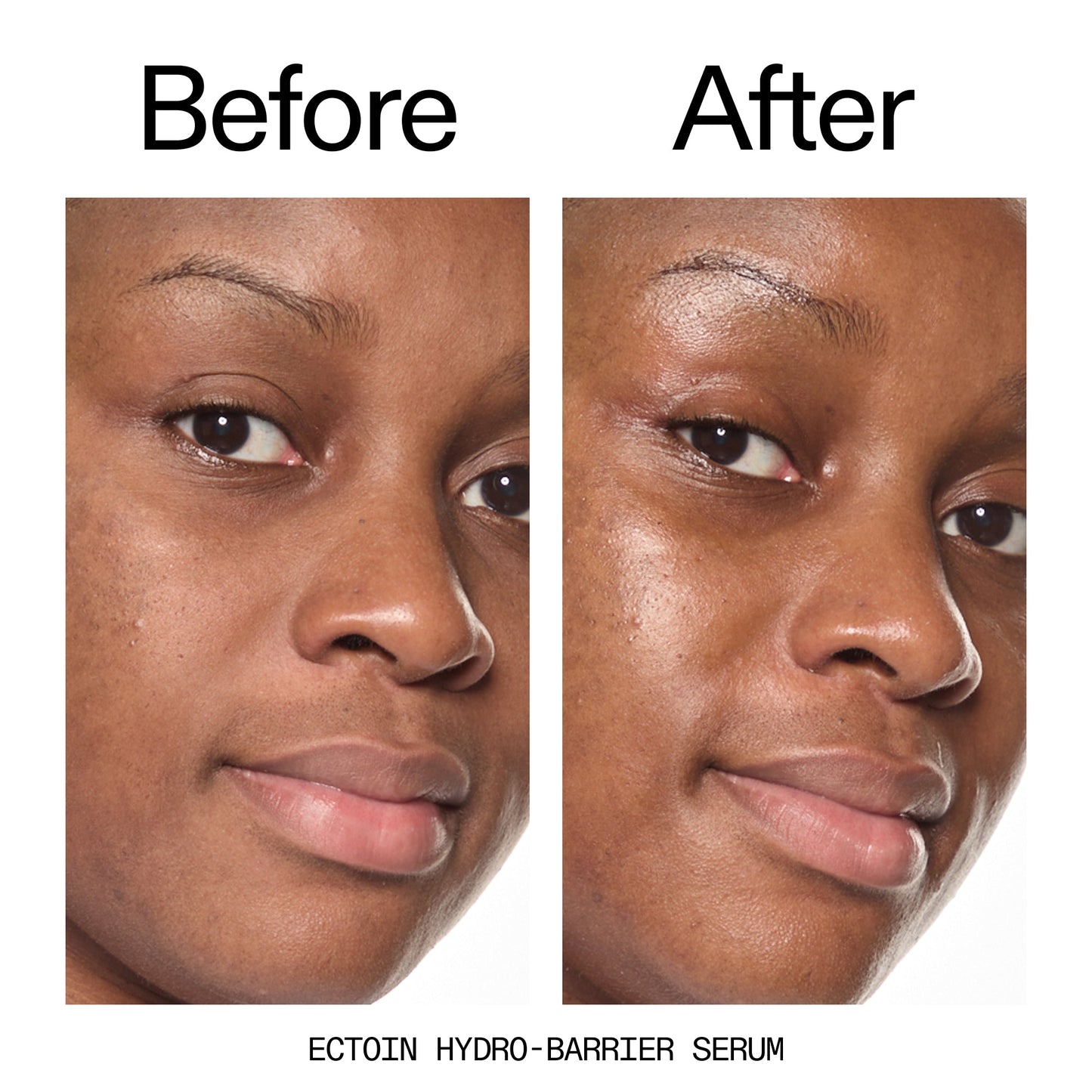 barrier-boosting-trio-z5 Ectoin_Before_After_2000x2000_ce35bc41-4da0-4b6f-adc7-29f8641f6c6c.jpg