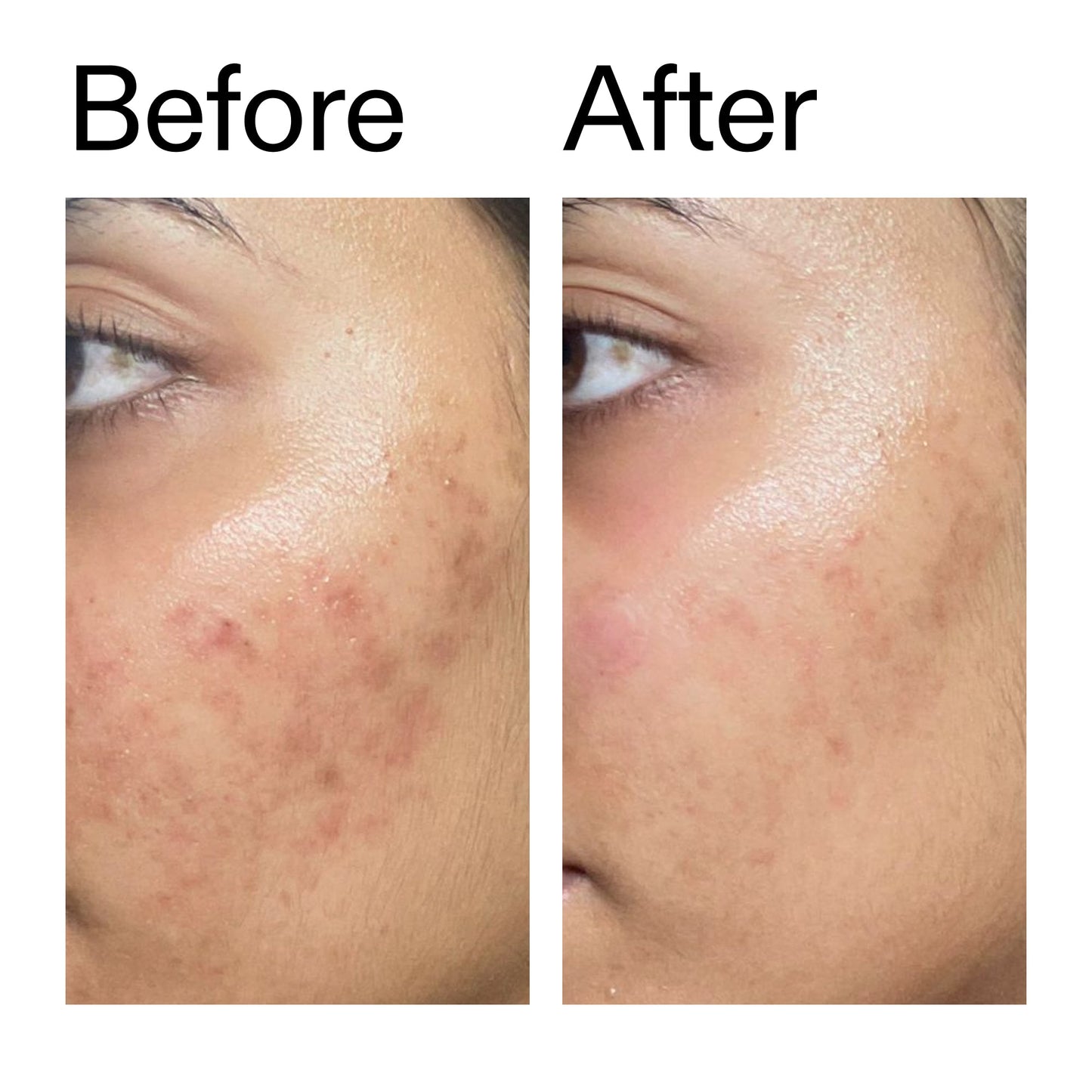 ectoin-hydro-barrier-serum-e0 Ectoin_Hydro-barrier_Serum__Before_After_2000x2000_34261920-d004-48d0-9c7b-8e1c15971bfd.jpg