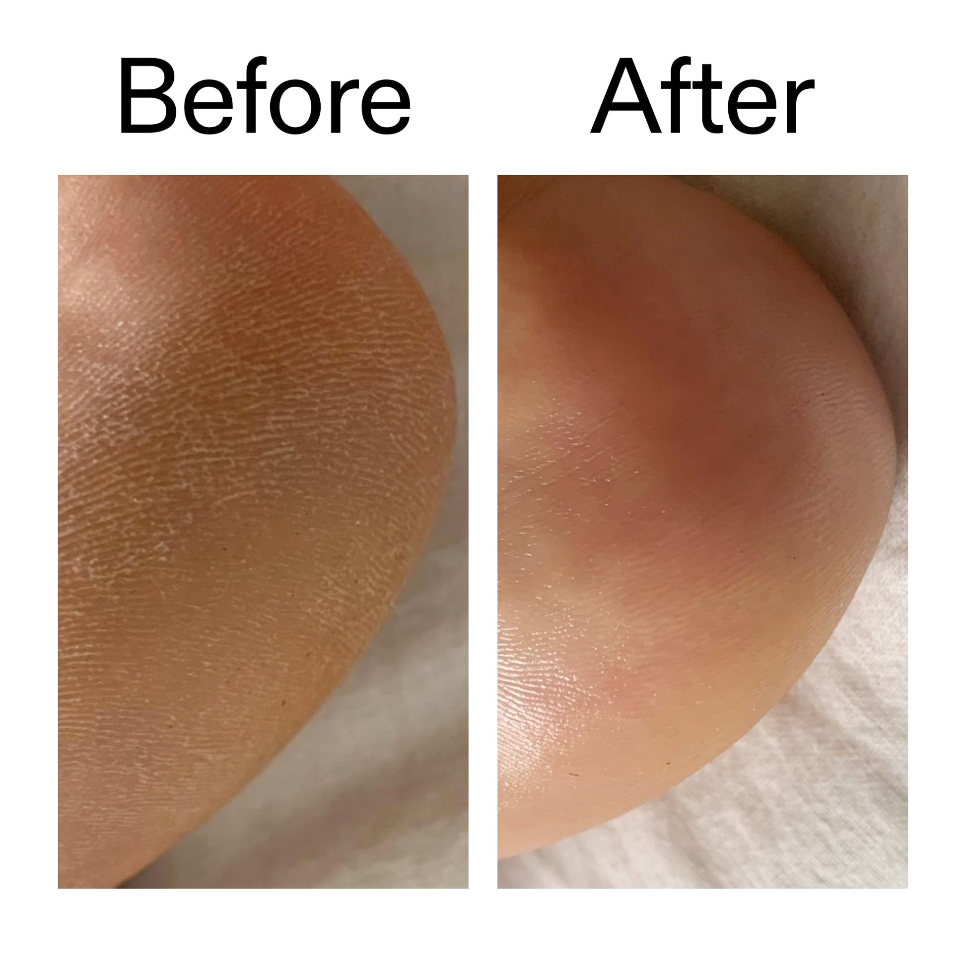 glycolic-acid-exfoliating-body-stick-s2 Glycolic_Acid_Exfoliating_Body_Stick_Before_After_V1_2000x2000_a3043625-9400-429a-a7fb-d6dbd220f722.jpg