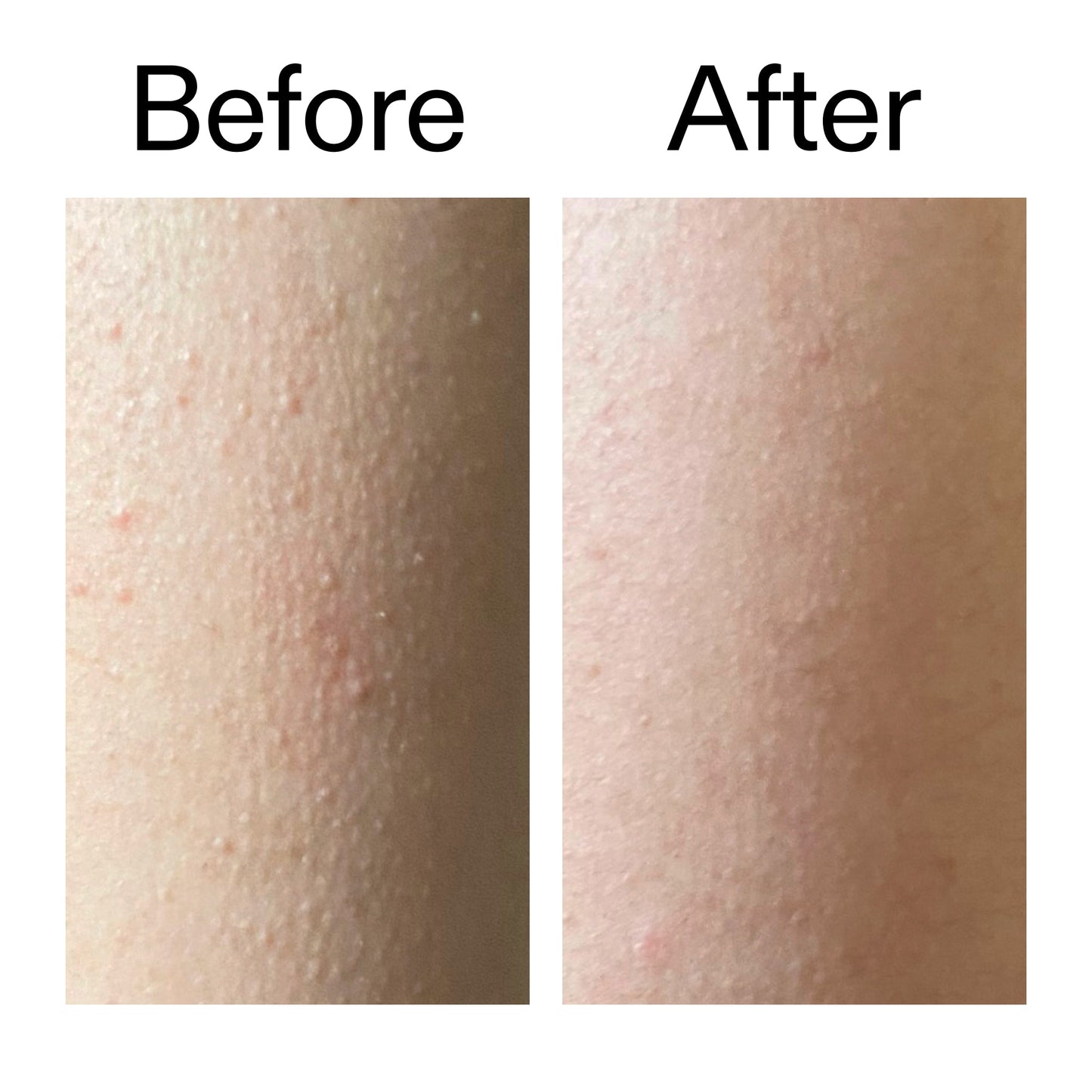 glycolic-acid-exfoliating-body-stick-s2 Glycolic_Acid_Exfoliating_Body_Stick_Before_After_V2_2000x2000_2e4ba052-94f6-4d56-82df-7bdb5b2df7ae.jpg