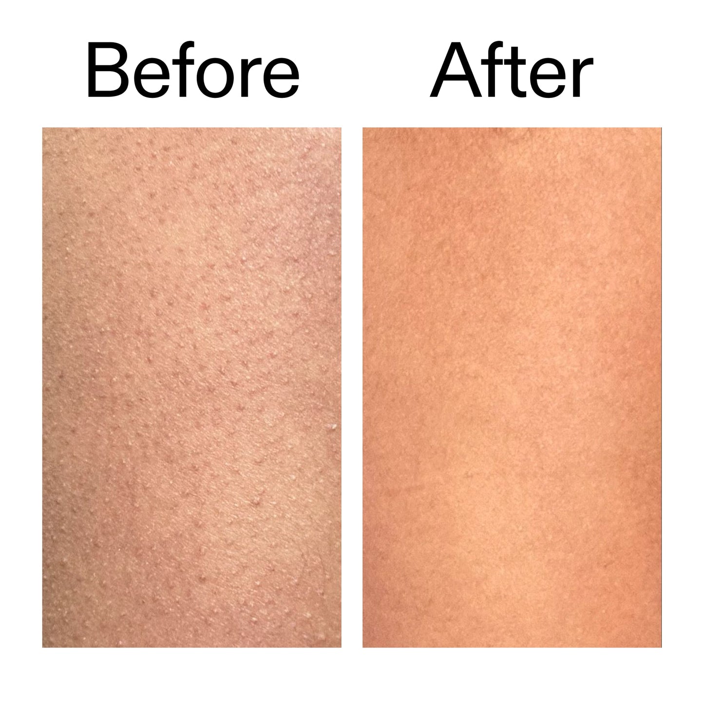 glycolic-acid-exfoliating-body-stick-s2 Glycolic_Body_Stick_B_A_2000x2000_6e6e6b4d-5bd7-43c0-aeed-4d66788e8995.jpg