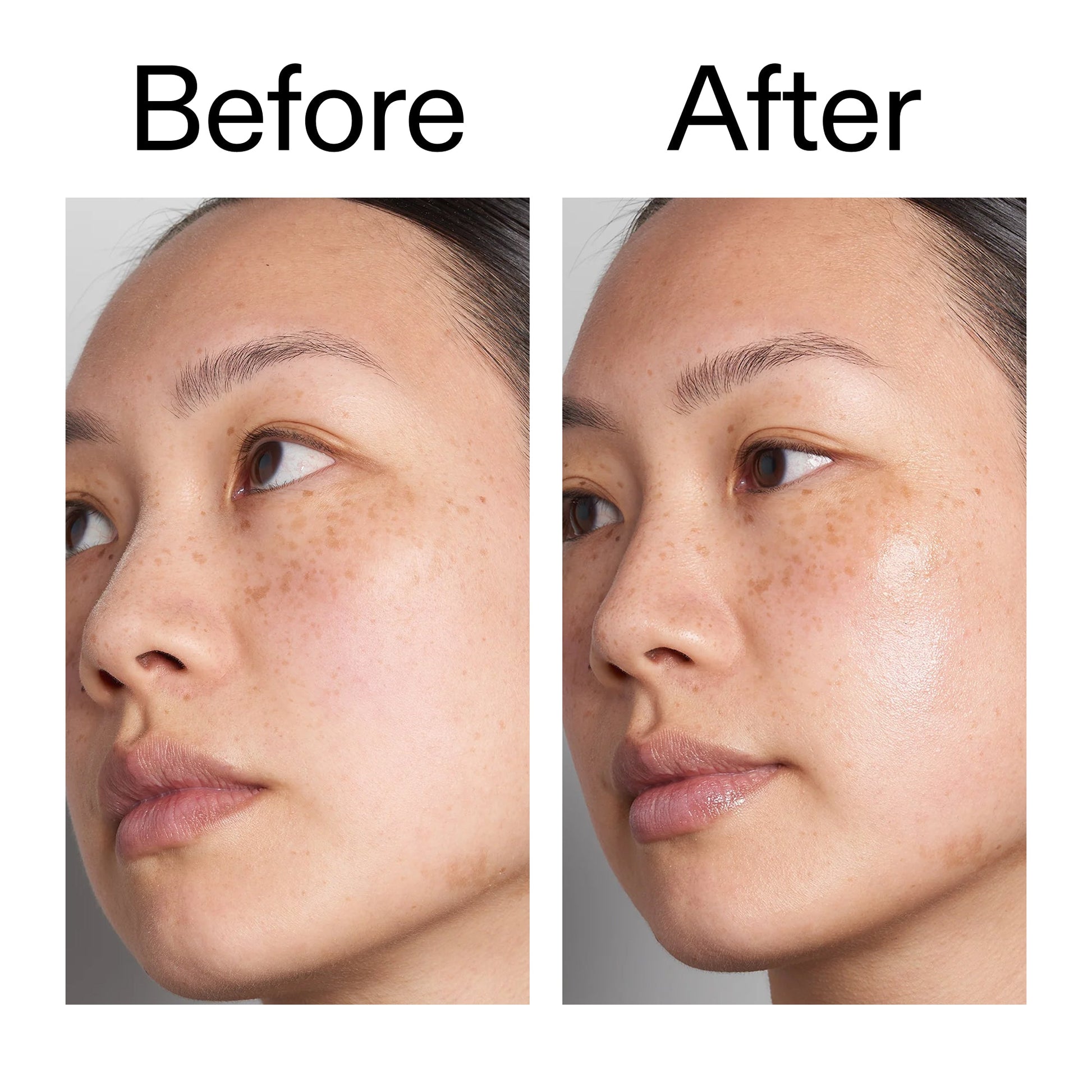 supersize-hyaluronic-acid-serum-100ml-s1 Hyaluronic_Acid_Before_After_2000x2000_d7983956-8aa2-4ea3-8255-c63e8d4f892e.jpg