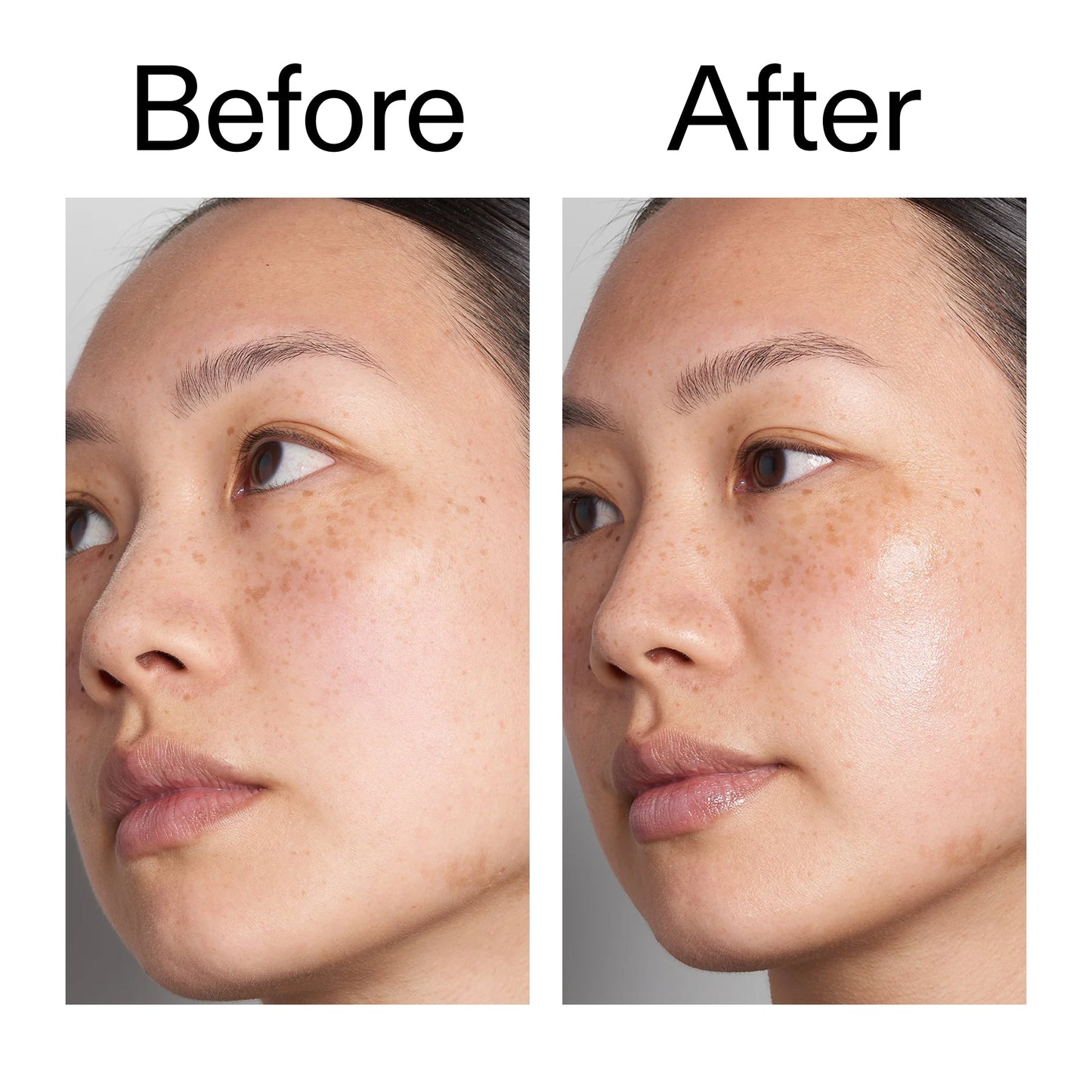 hyaluronic-acid-serum-60ml-duo-i3 Hyaluronic_Acid_Before_After_2000x2000_d566f5ba-a77e-4585-99fd-0f4682b164dd.jpg