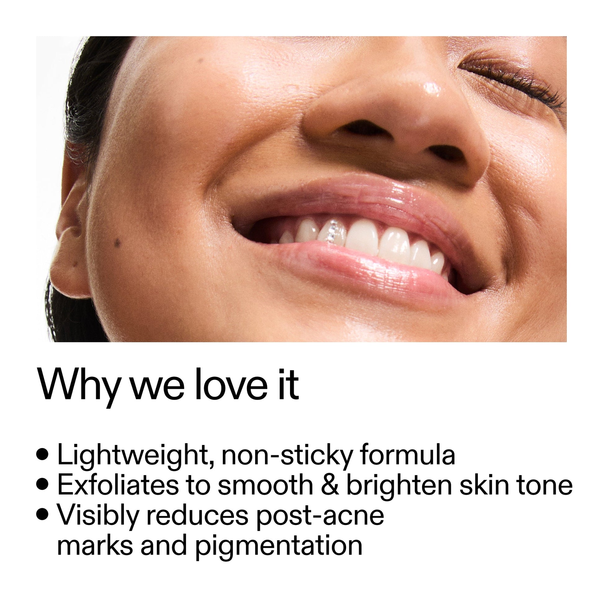 mandelic-acid-treatment-p3 Mandelic_Acid_Treatment_Why_we_love_it_2000x2000_6dfe29a9-2a79-464f-a5e8-e5ac37d93388.jpg