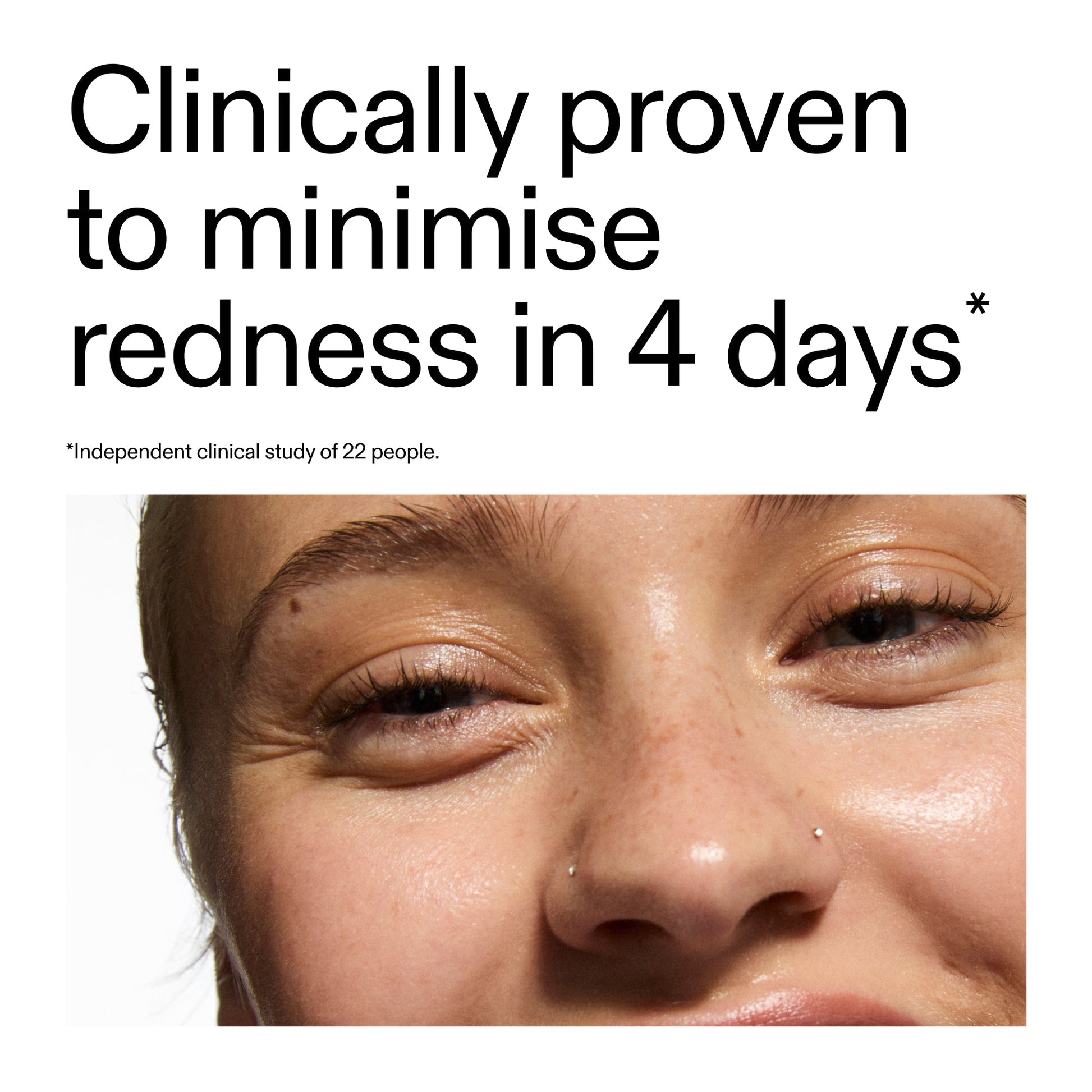 10-azelaic-acid-serum-for-redness-relief-f1 Oat_Cleansing_Balm_Claim_2000x2000_52a841dc-353c-4f2c-8646-3aadb604507d.jpg