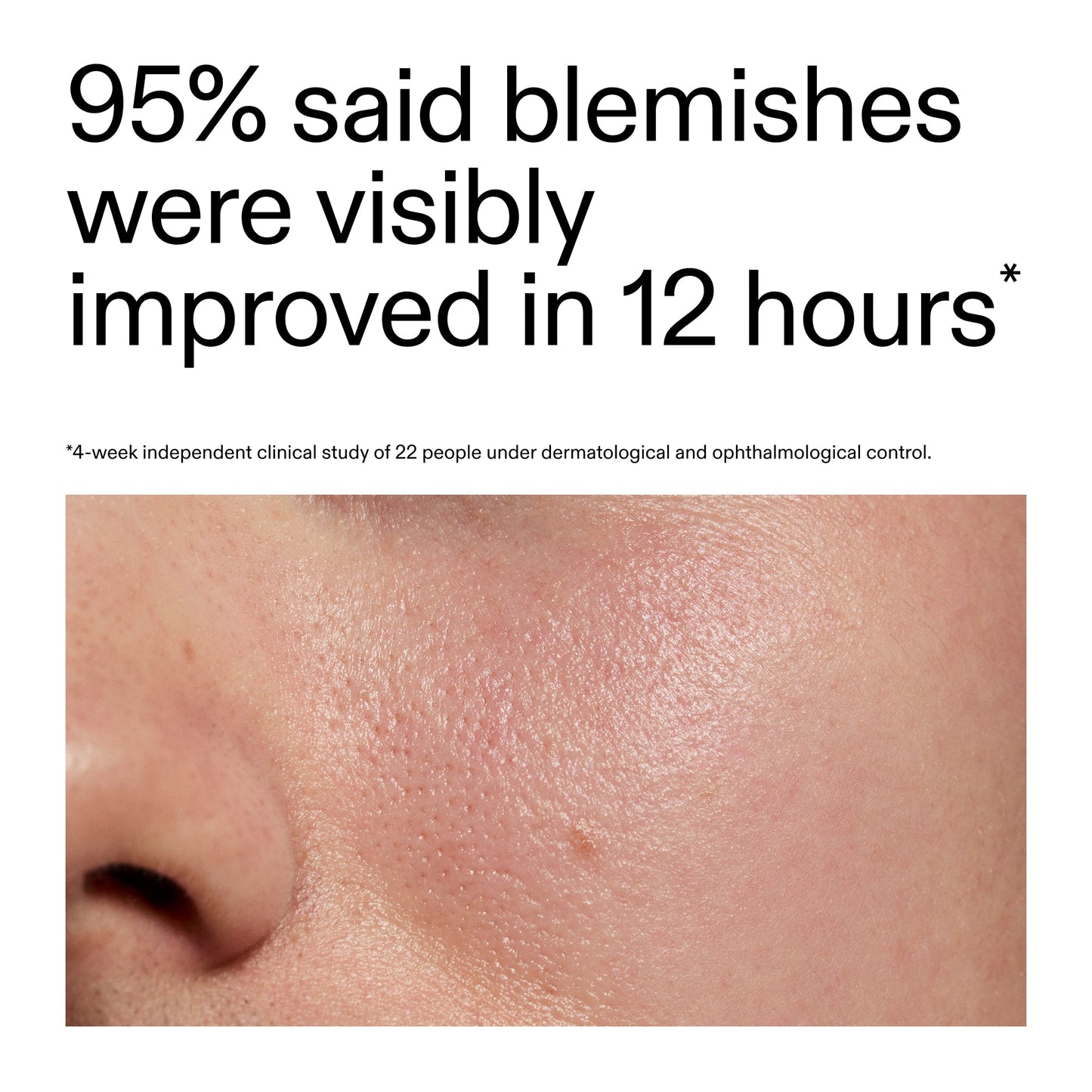 succinic-acid-acne-treatment-a8 Oat_Cleansing_Balm_Claim_2000x2000_ac6ce553-25db-41b2-a981-faae1ac4b8c0.jpg