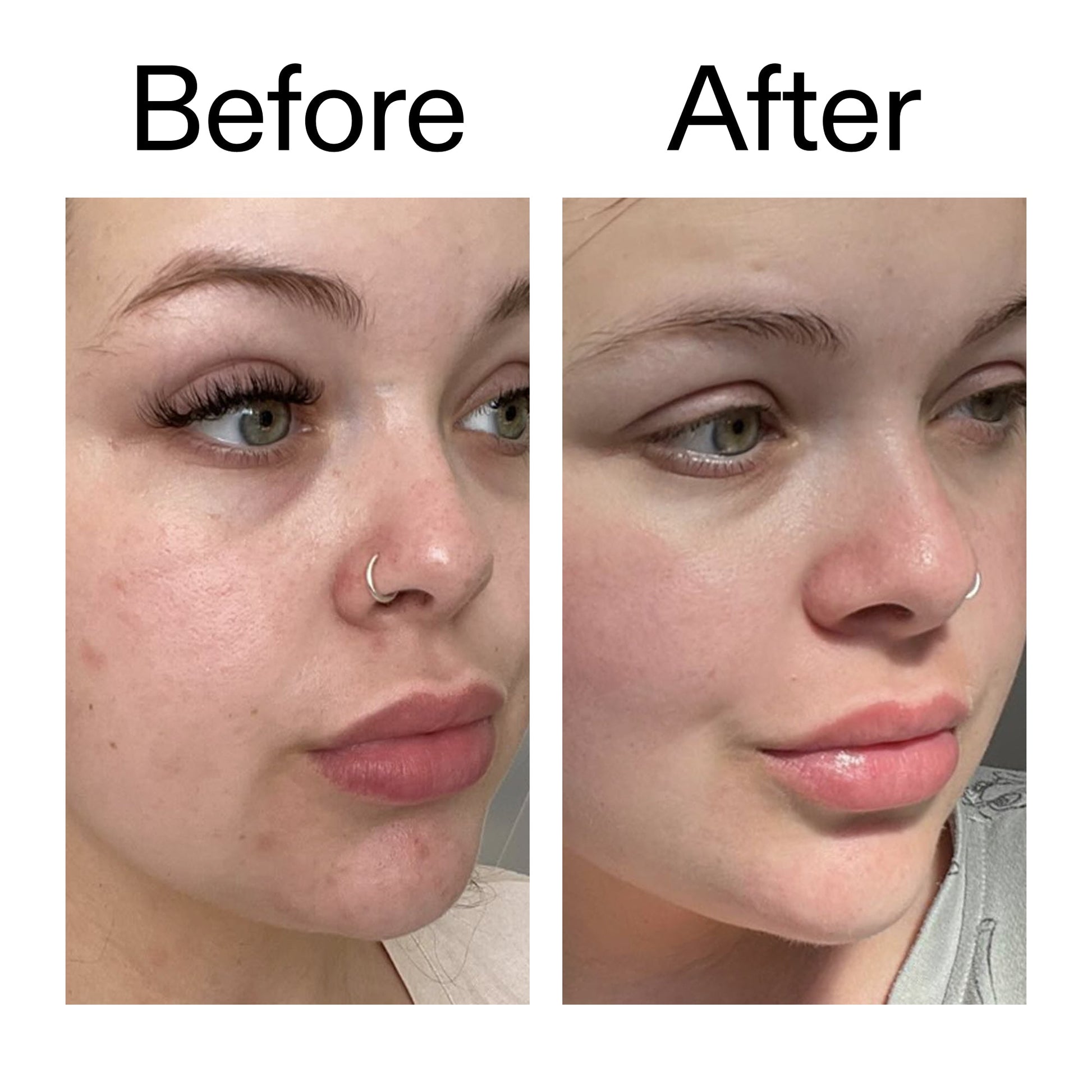 omega-water-cream-50ml-d2 Omega50_Before_After_2000x2000_46483ed8-3f9d-487f-9a0c-9df79830bd65.jpg