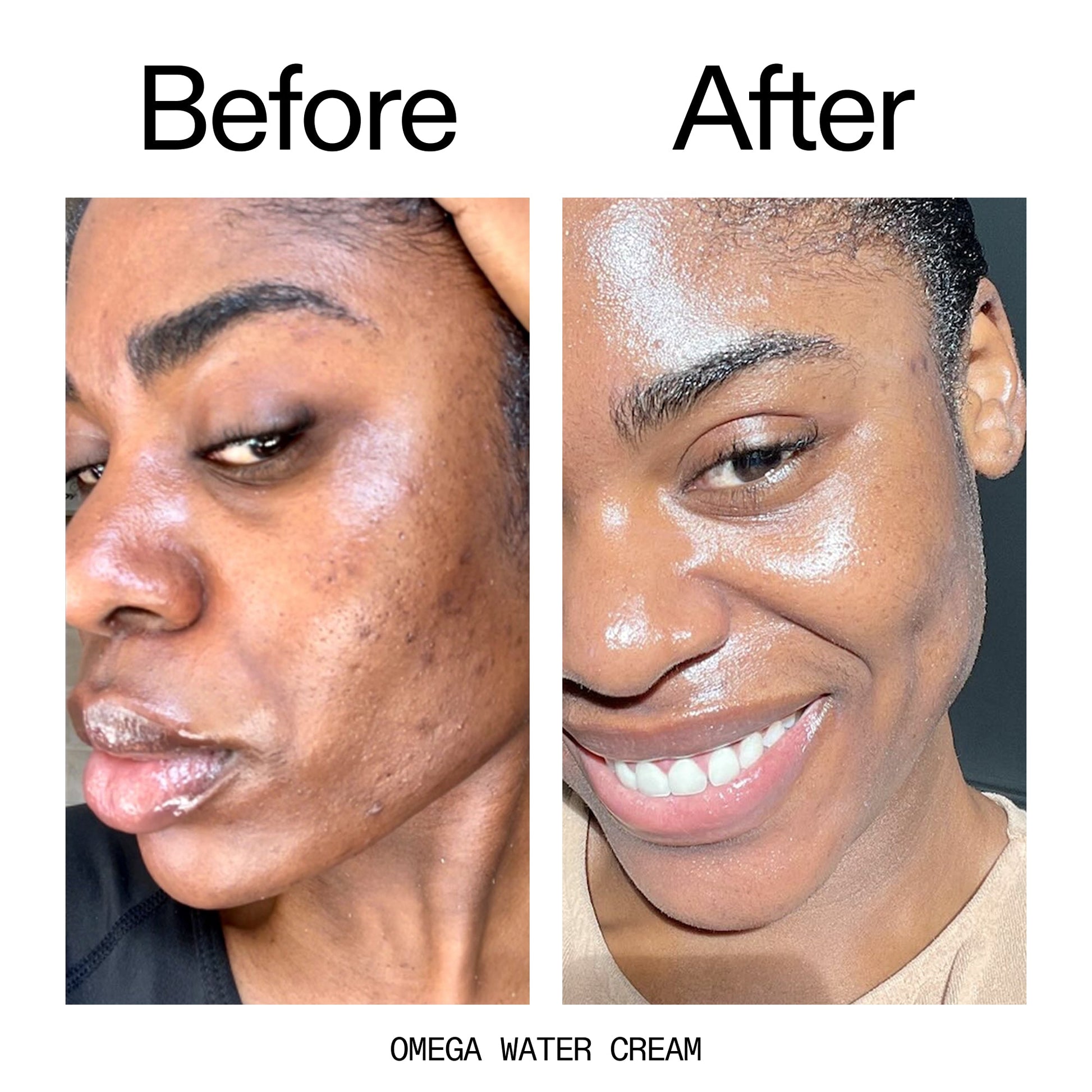 glowing-skin-set-j4 Omega_Water_Cream_Before_After_2000x2000_8e88278b-8c8d-48dc-ac77-4e98ebbd1b77.jpg