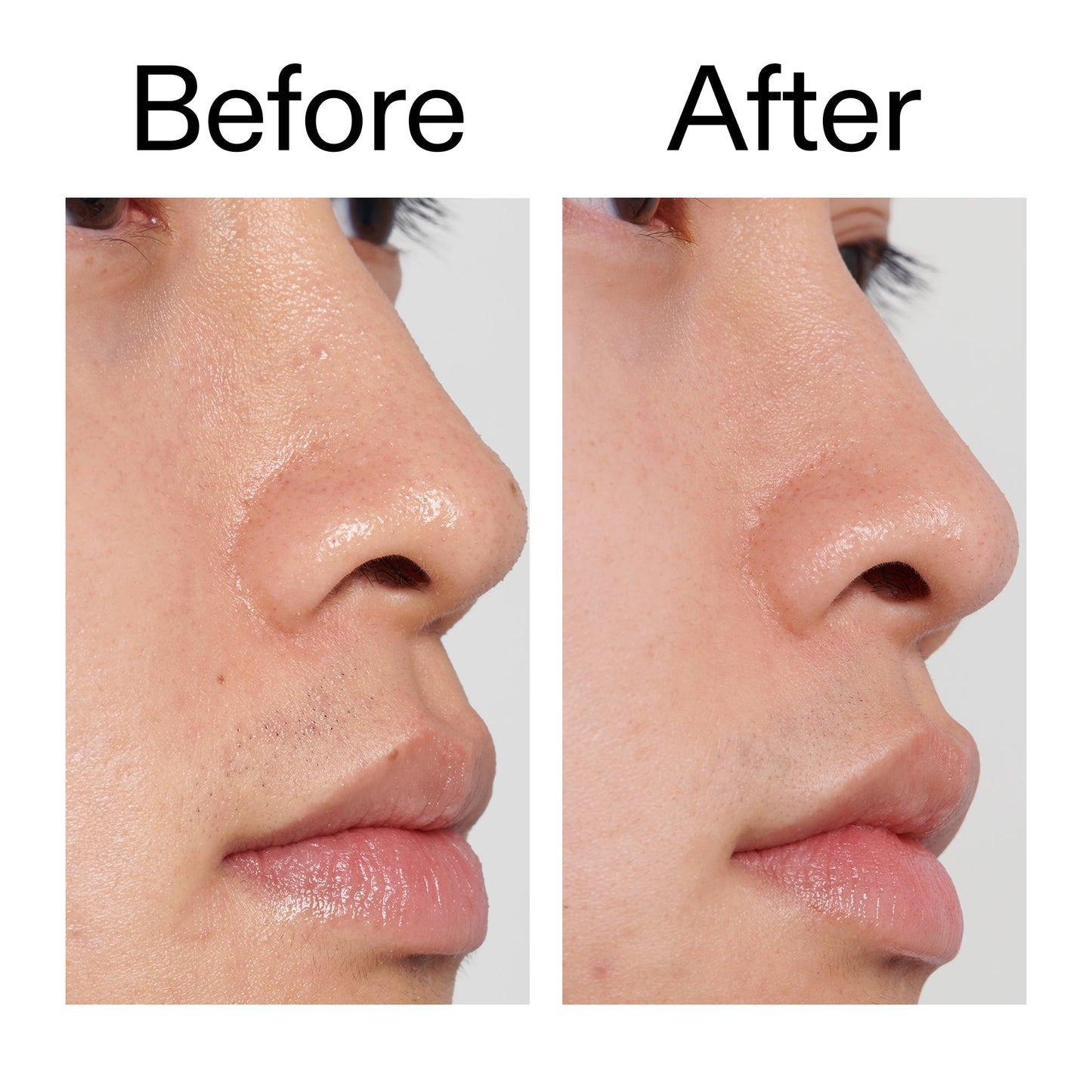 pha-toner-g8 PHA_Toner_Before_After_2000x2000_e3c10172-0150-4342-8b95-57417eaff50d.jpg
