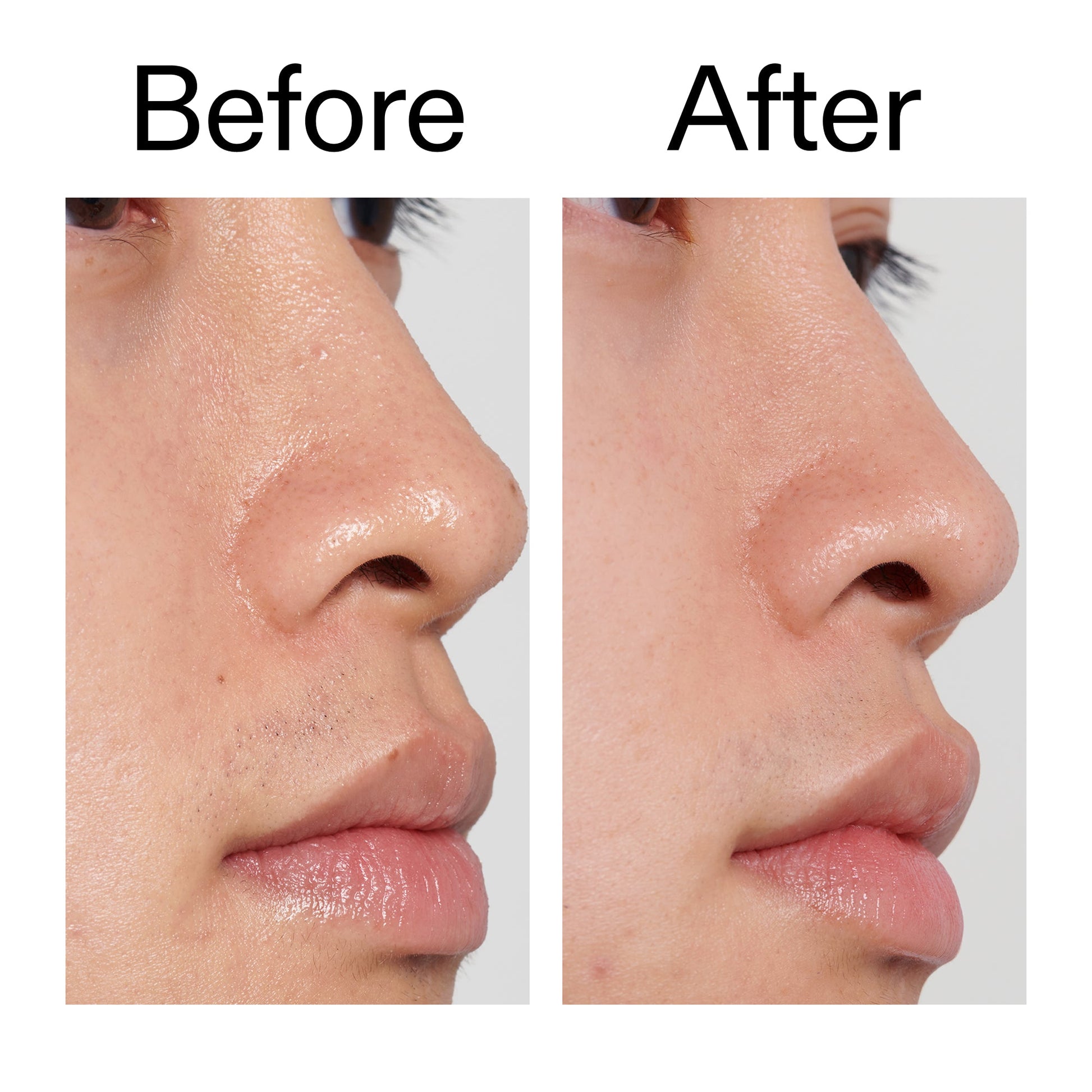 pha-toner-g8 PHA_Toner_Before_After_2000x2000_e3c10172-0150-4342-8b95-57417eaff50d.jpg