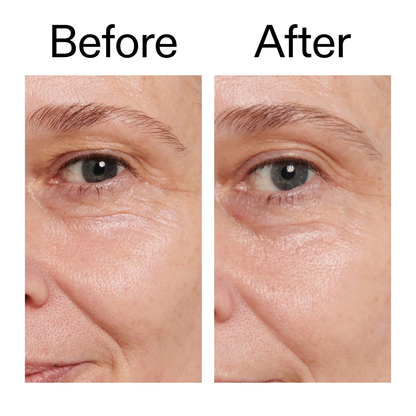 retinol-eye-cream-v3 Retinol_Eye_Cream_Before_After_2000x2000_ac03a80c-109e-4572-a95a-91dc109b4d27.jpg