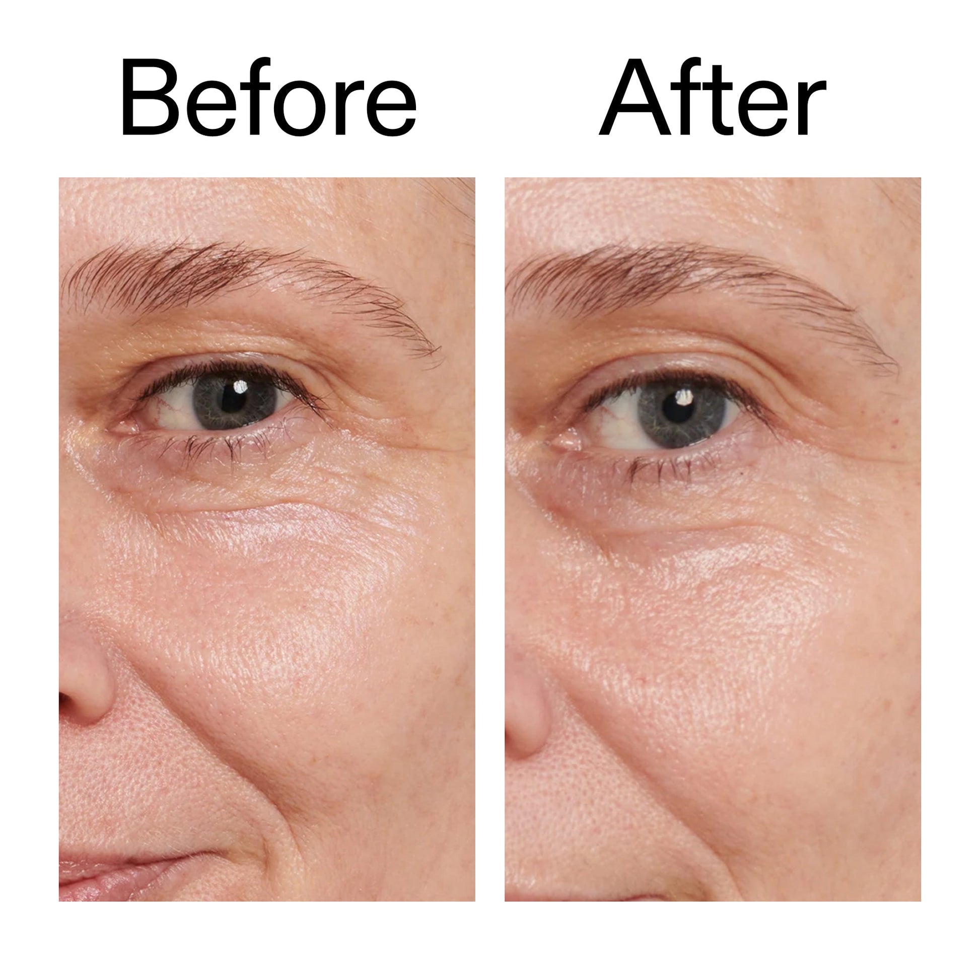 retinol-eye-cream-v3 Retinol_Eye_Cream_Before_After_2000x2000_ac03a80c-109e-4572-a95a-91dc109b4d27.jpg
