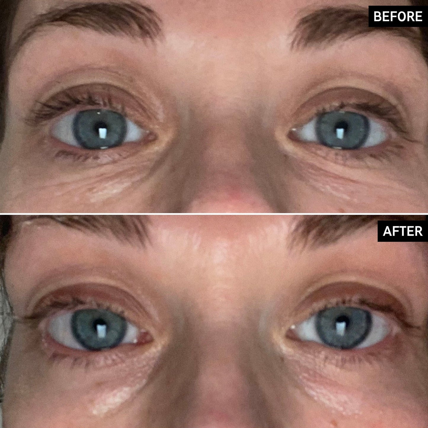retinol-eye-cream-v3 SITE-UGCBAsApril_Nicole_B_A_PPage_2000x2000_1.jpg