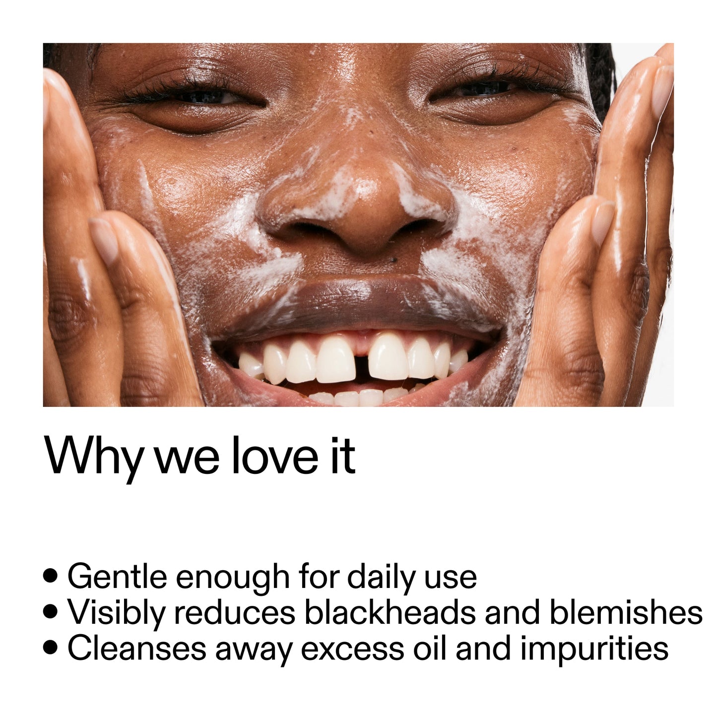 salicylic-acid-cleanser-150ml-u0 Salicylic_Acid_Cleanser_-_300mlWhy_we_love_it_2000x2000_87dc92a9-2559-4309-98cd-4e570f1be735.jpg