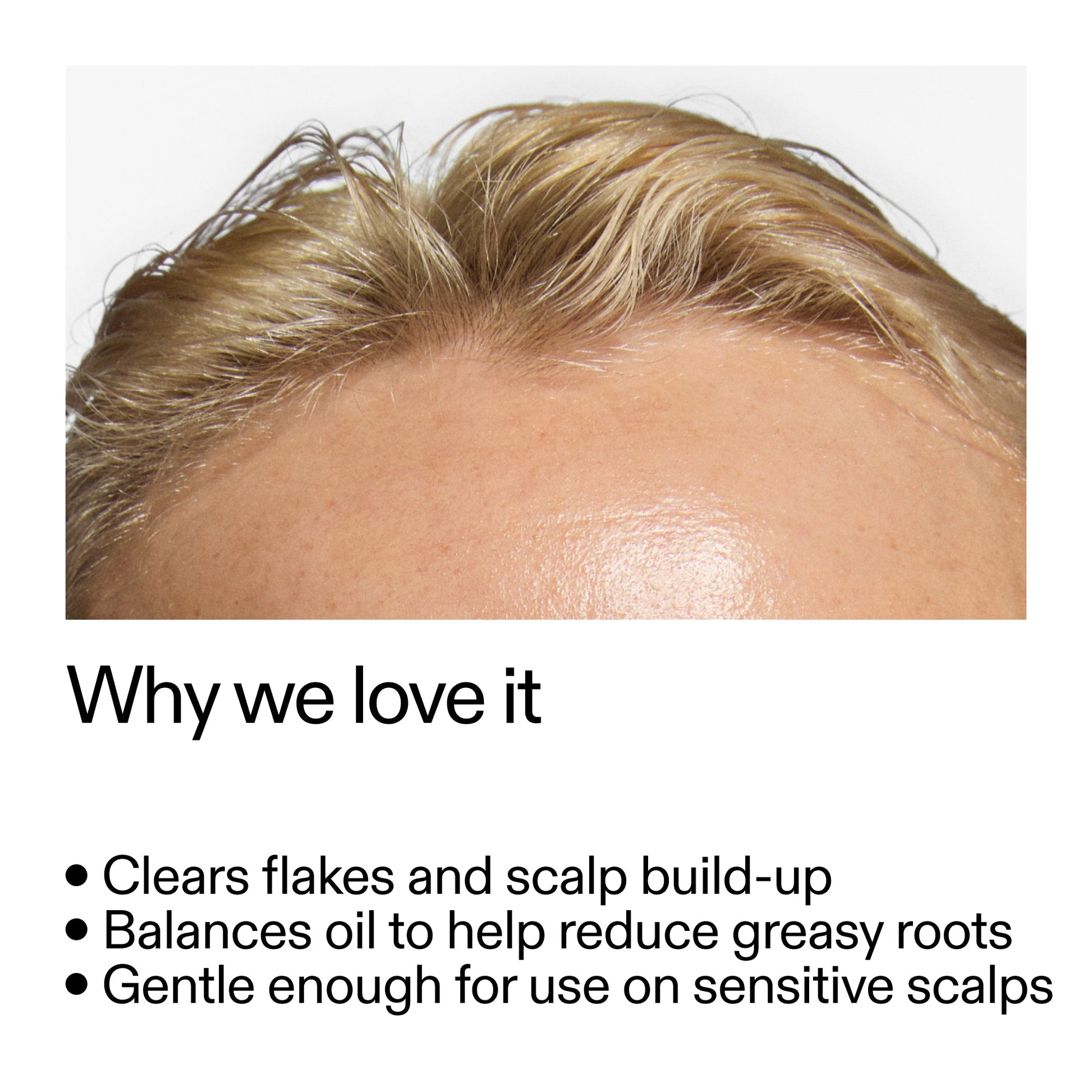 salicylic-acid-exfoliating-scalp-treatment-q6 Salicylic_Acid_Exfoliating_Scalp_Treatment_Why_we_love_it_2000x2000_44b6bd6d-9ec4-4b23-9dc4-bc3fd6f28e14.jpg