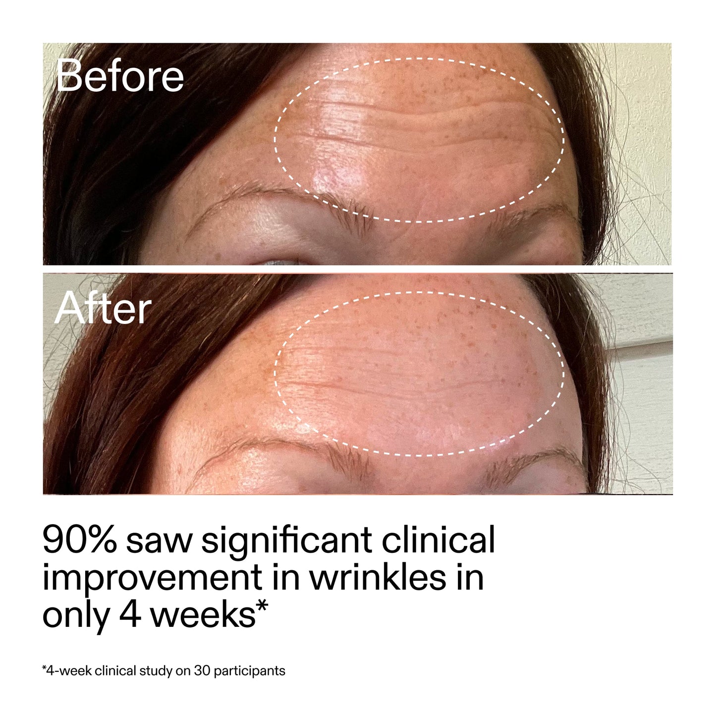starter-retinol-serum-duo-j8 StarterRetinol_BeforeAfter_Claim1_2000x2000_03b4d6e5-a357-43b9-a855-aba5e35c57f3.jpg