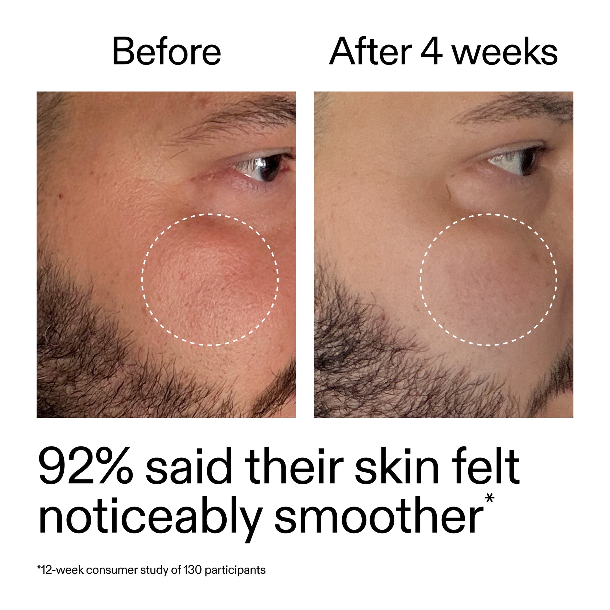 starter-retinol-serum-x2 StarterRetinol_BeforeAfter_Claim3_2000x2000_6ceab106-e0ee-4ed4-ba62-41bc39538038.jpg