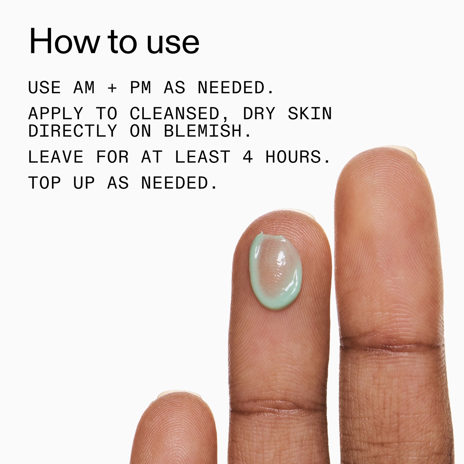 succinic-acid-acne-treatment-a8 Succinic_Acid_Treatment_How_to_Use_2000x2000_d57137d5-d7f1-427c-9a46-5fc00c19c542.jpg
