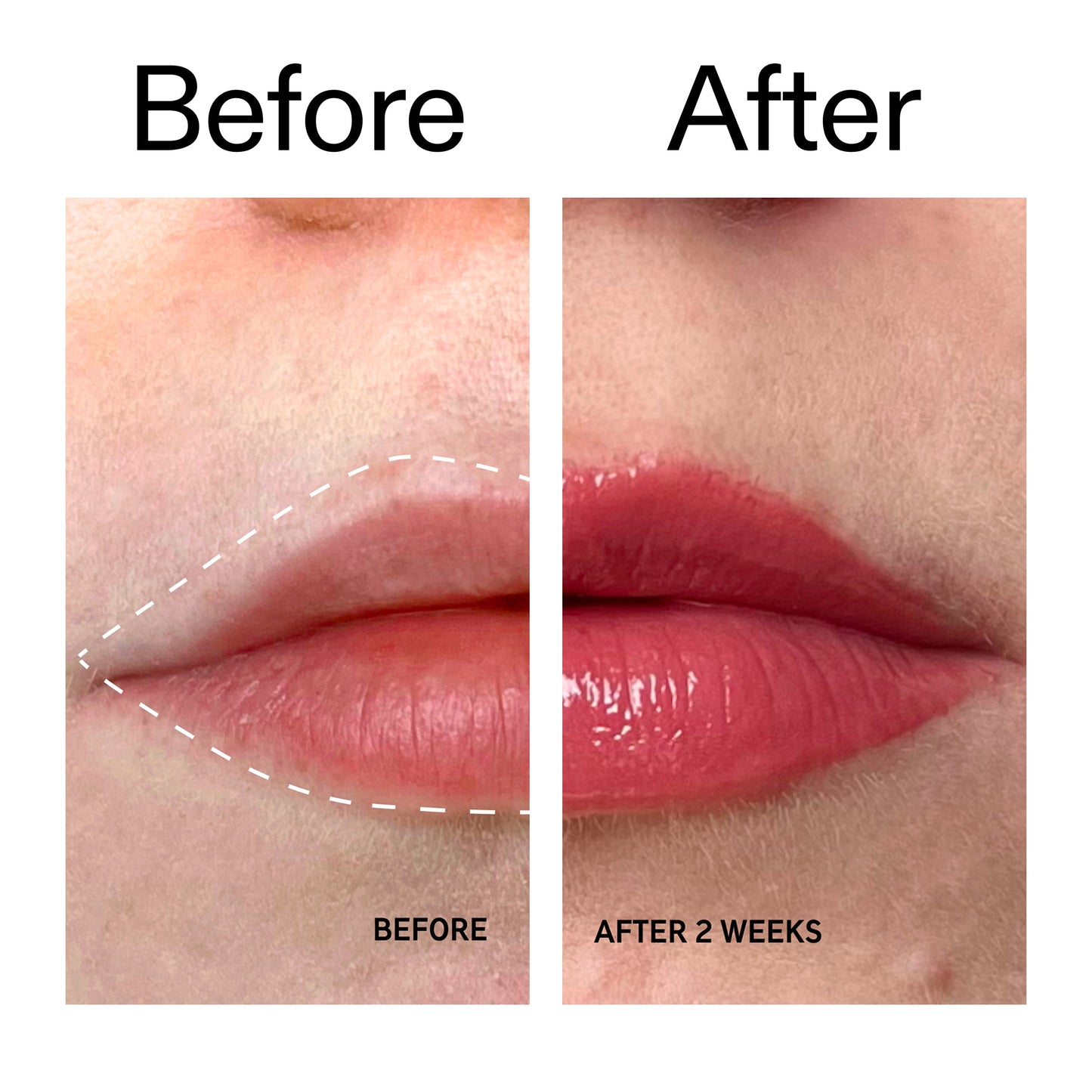 tripeptide-plumping-berry-lip-balm-l2 Tripeptide_Plumping_Lip_Balm_-_Berry_Before_After_2000x2000_9474bbd8-43ca-4b0e-b0e7-dfab70b91927.jpg