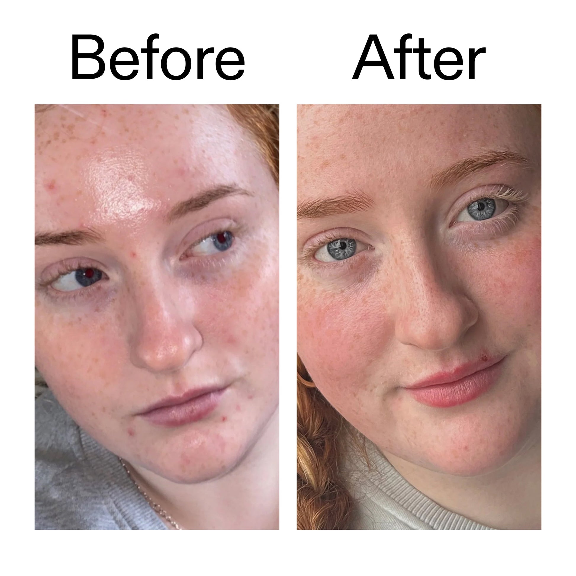 vitamin-b-c-and-e-moisturizer-z1 Vitamin_B_C_and_E_Moisturizer_Before_After_2000x2000_b0781a76-5ad2-4be9-95b8-ef92b356833c.jpg